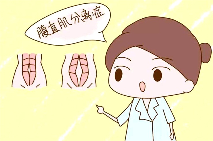 腹直肌分離問題，產(chǎn)后康復治療儀幫助您