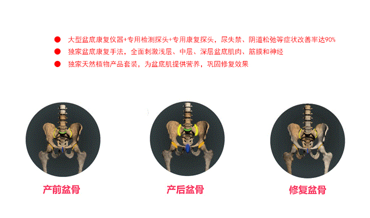 打噴嚏就漏尿，你的盆底肌修復好了嗎？
