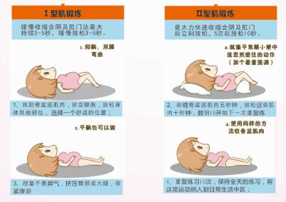 產后盆底肌修復治療設備，還以為剖腹產不用做盆底康復嗎？