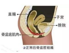 產(chǎn)后盆底肌怎么修復(fù)？你得做好盆底功能檢測(cè)