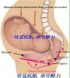 產(chǎn)后盆底康復(fù)治療開(kāi)始后，出現(xiàn)陰道出血怎么破？