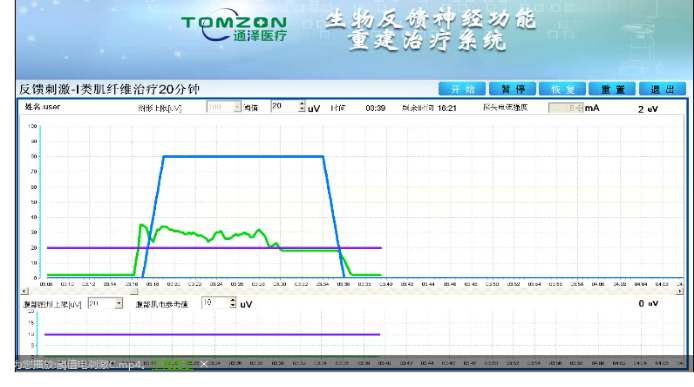 盆底康復(fù)治療怎么做？盆底康復(fù)治療肌電生物反饋治療儀的機(jī)理是什么？