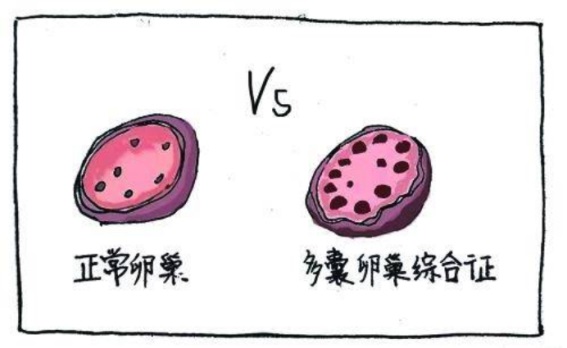 盆底肌康復(fù)治療怎么做，盆底肌修復(fù)十大常見(jiàn)問(wèn)題（下）