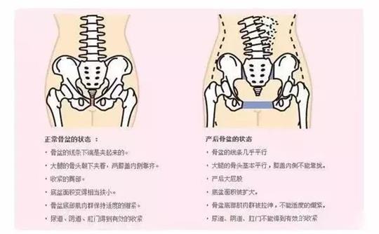 產(chǎn)后修復(fù)治療儀器對于腹直肌修復(fù)有效果嗎？