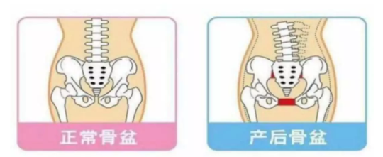別大意！進(jìn)行產(chǎn)后修復(fù)項(xiàng)目，要選擇專業(yè)的產(chǎn)后修復(fù)中心