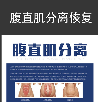 馬麗挺孕肚登春晚，孕婦還應該知道腹直肌分離的相關(guān)知識