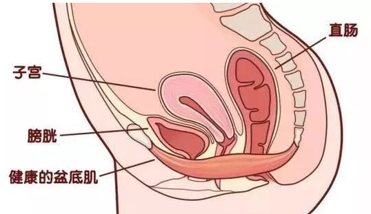 除了腹直肌修復，盆底康復也得重視，恢復好身材