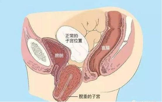 產后康復是否可以選擇儀器？