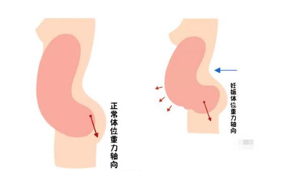 盆底恢復(fù)是否可以使用儀器？
