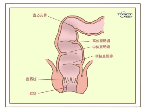 盆底康復(fù)治療儀對(duì)產(chǎn)后便秘有哪些幫助？