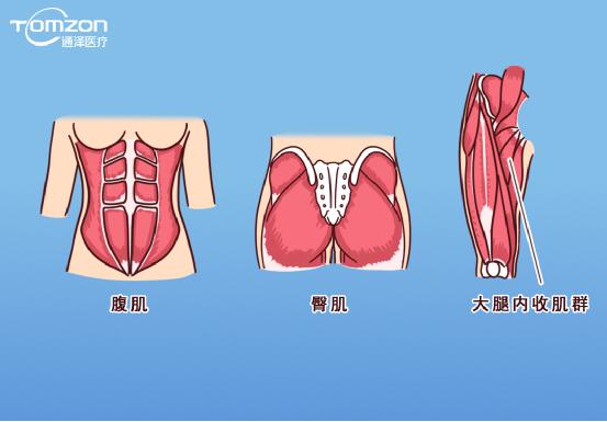 凱格爾運動該怎么做？盆底肌修復(fù)儀器還能用嗎？