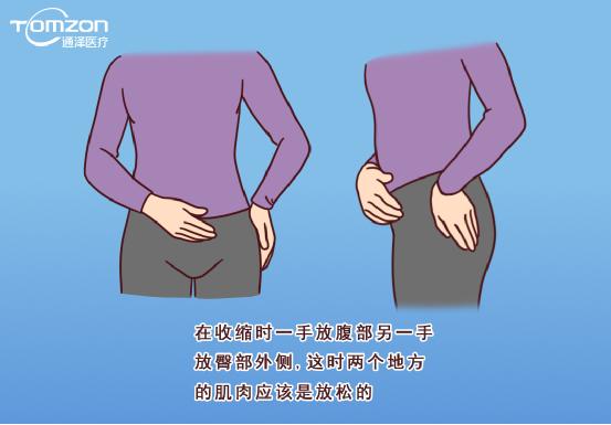 盆底康復(fù)治療儀能不能改善腹直肌分離？