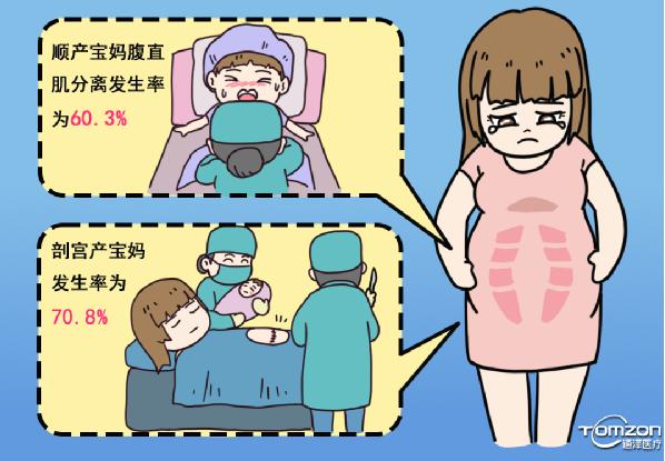   產(chǎn)后康復(fù)能夠改善哪些問題？