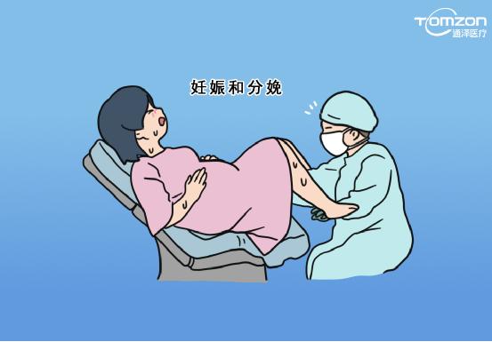 盆底康復(fù)治療儀是否可以促進(jìn)盆底肌肉康復(fù)？