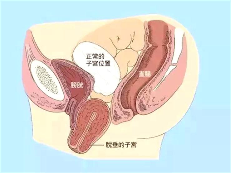 產后修復項目